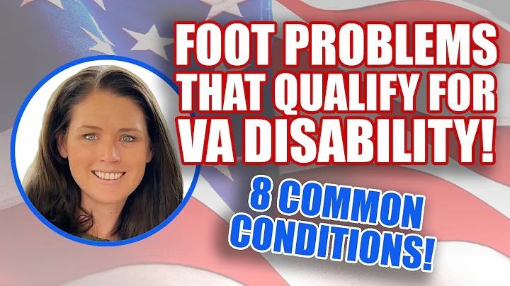 What Foot Problems Qualify for VA Disability? 8 Common Conditions!