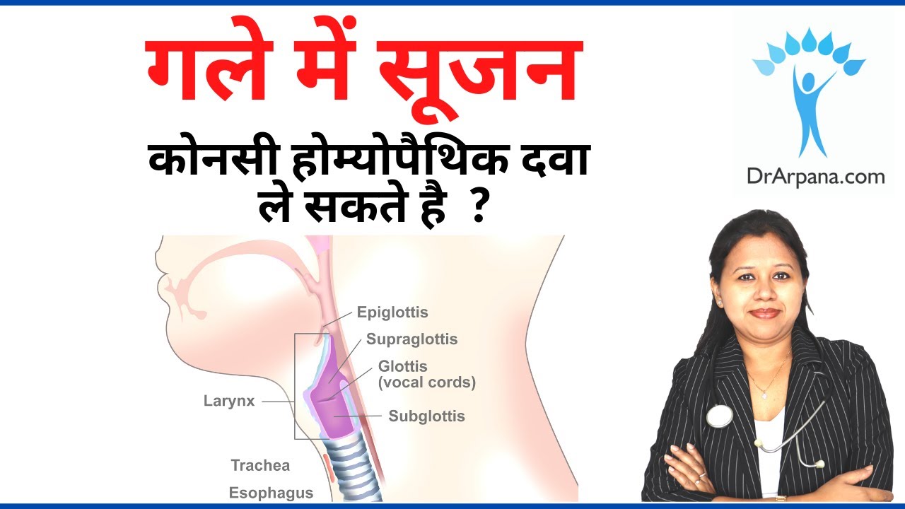 गले में सूजन की 5 बेस्ट होम्योपैथिक दवा || Larynx Edema Homeopathic Medicines