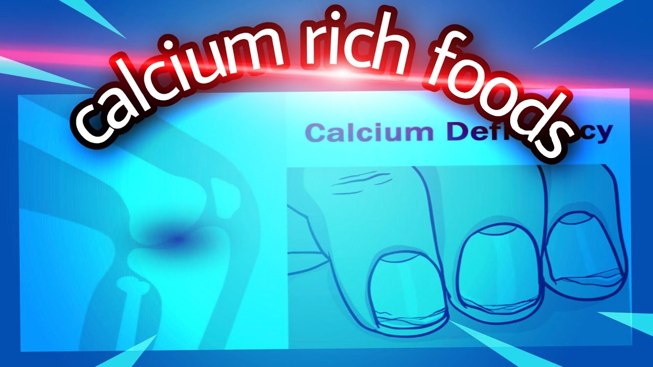 Calcium rich foods - YouTube