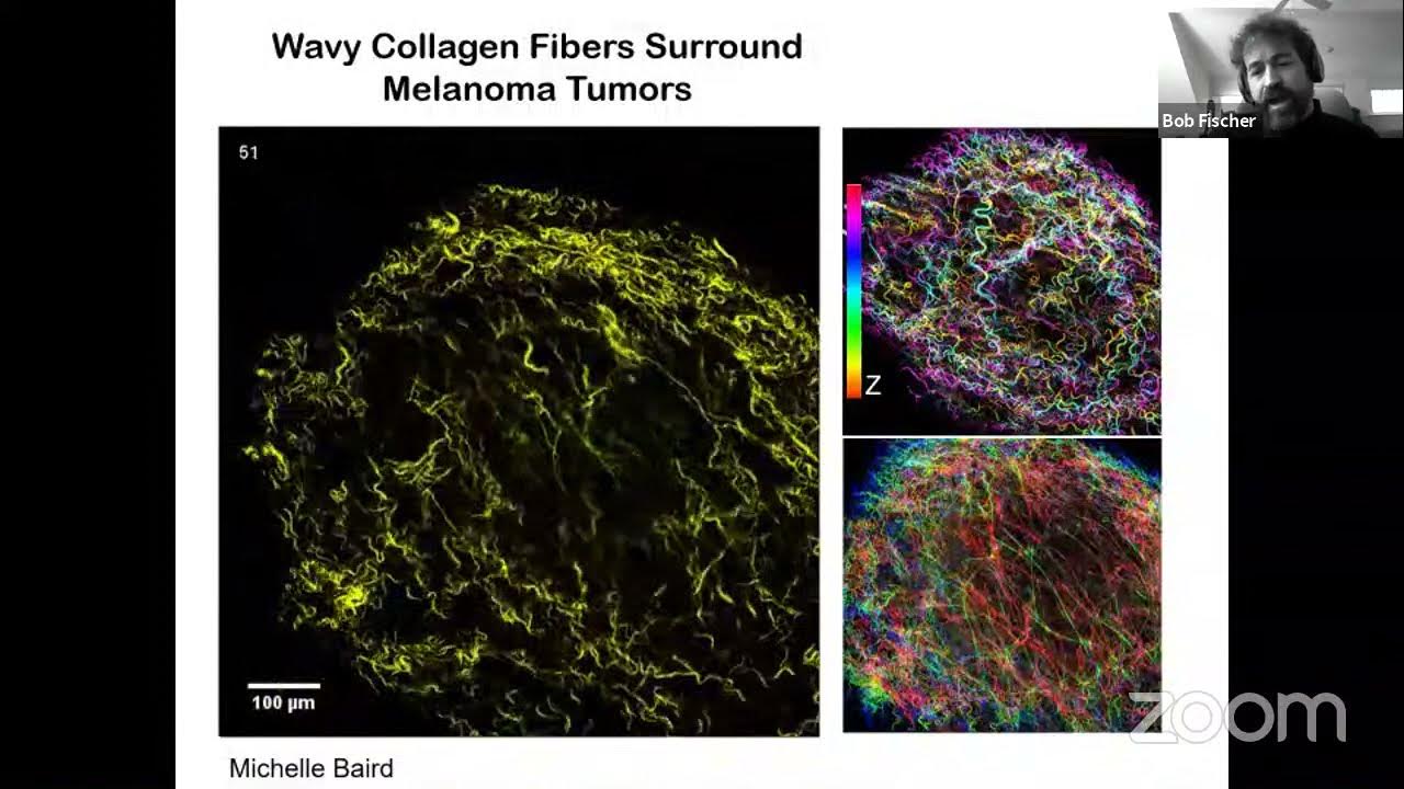 Cell Migration Seminars 34 Dr. Robert Fischer & Prof. Isabelle Caillé