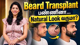 Beard Transplant பண்ணினா… Natural Look வருமா? 🧔✨ | Beard Transplant Results