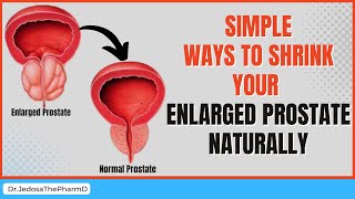 How to Shrink Your Enlarged Prostate Naturally