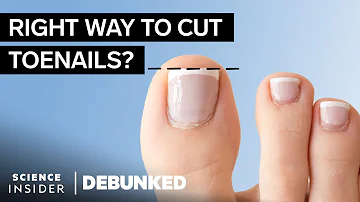 Do podiatrists just cut toenails?