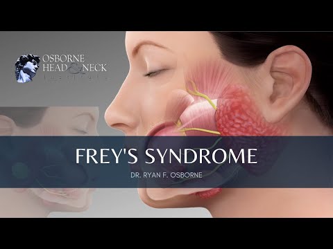 Frey&rsquo;s Syndrome: Information, Prevention, and Treatment Explained By Dr. Ryan F. Osborne