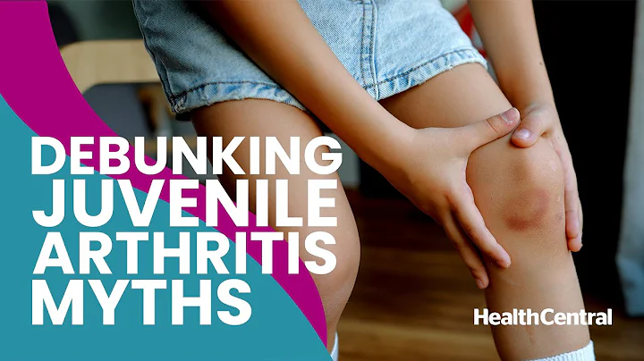 Fake or Fact? Juvenile Idiopathic Arthritis Edition