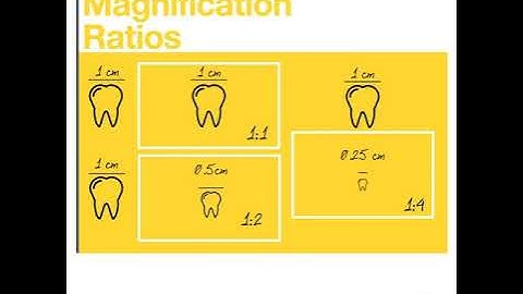 Clinical Photography Basics, understanding magnification ratios and its role in dental photography