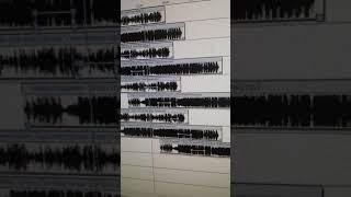 Anne Marie vs Burak Yeter vs Don Diablo - Ciao Adios vs When The Beat Drops Out (Miloš Mrdak Mash Up