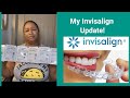 My Invisalign Update! A Before and During!