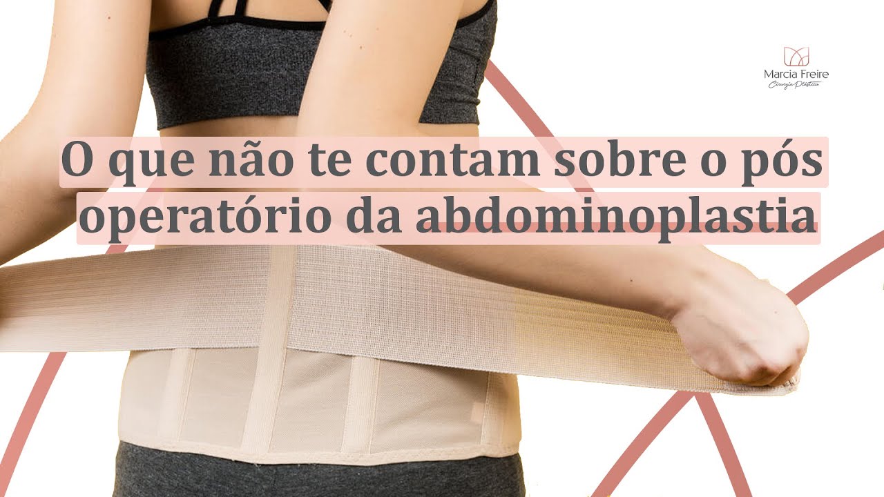 8 dicas que ninguém fala após a abdominoplastia