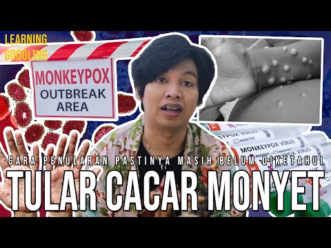 Cacar Monyet Lebih Menular Ke Pria Penyuka Sesama Jenis? Ngerinya Monkeypox! | Learning By Googling