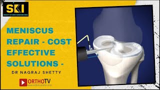 OrthoTV Original - Meniscus Repair - Cost Effective Solutions - Dr Nagraj Shetty screenshot 5