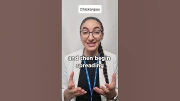 Chickenpox symptoms | @pharmacistv NHS #shorts