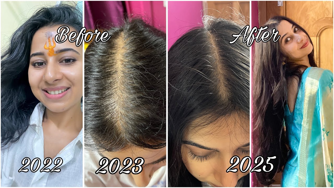 8 Hair Growth Serums for Reduced Hair fall & Hair Growth ( what didn’t work? ) 