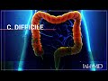 The Basics: C. Difficile | WebMD