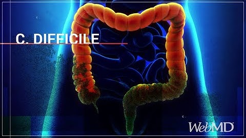 The Basics: C. Difficile | WebMD