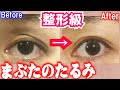 10分ケアで1週間で激変！上まぶたのたるみをとるマッサージ＆エクササイズ美顔ヨガ上瞼目の上のたるみ＆シワ•三重瞼改善