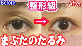 10分ケアで1週間で激変！上まぶたのたるみをとるマッサージ＆エクササイズ美顔ヨガ上瞼目の上のたるみ＆シワ•三重瞼改善
