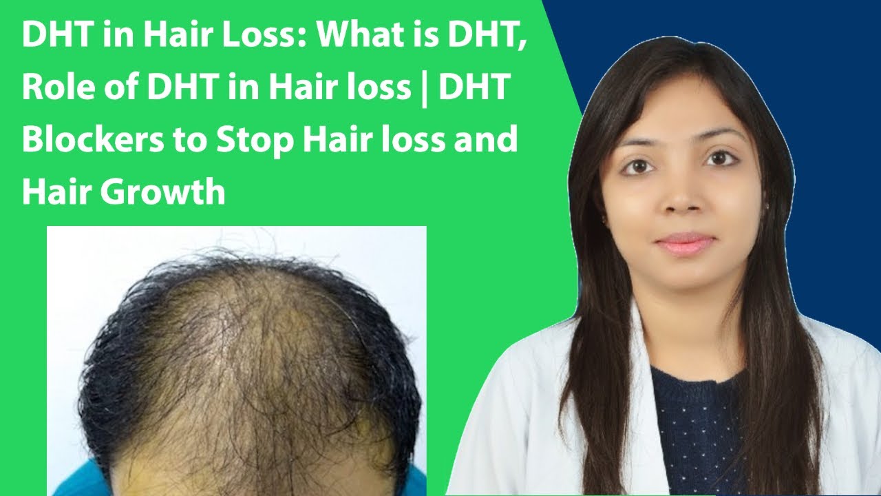 Hair Loss and DHT  Skalptec Ltd  Scalp Micropigmentation UK