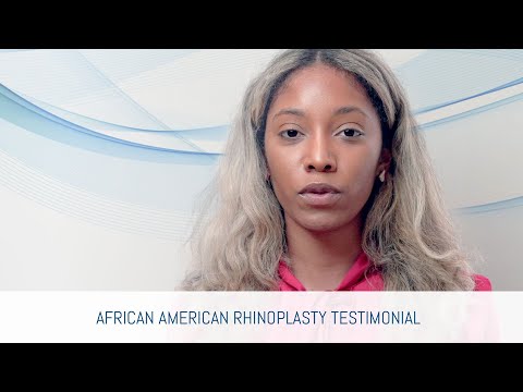 Video thumbnail: Transformative Journey: African American Rhinoplasty Testimonial Exposed · Dr. Anthony Bared, M.D - Facial Plastic Surgeon