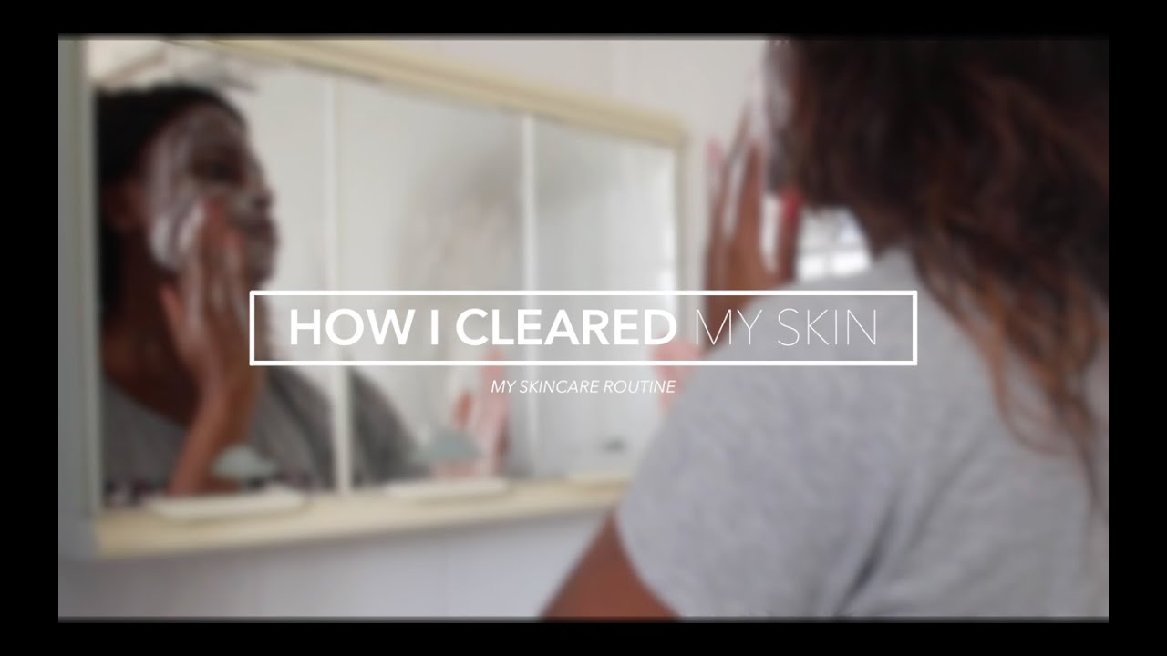 HOW I CLEARED MY ACNE | MY SKINCARE ROUTINE - YouTube