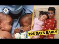 Most Premature Twins Celebrate Their 4th Birthday | Guinness World Records