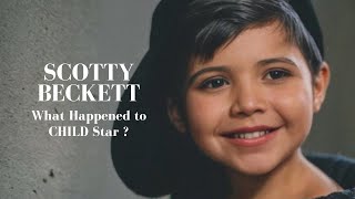 What Happened to CHILD Star Scotty Beckett?