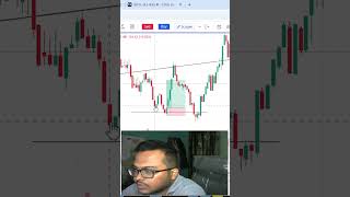 Option Buying Sensex #trading #shorts #short #sharemarket #stockmarket #nifty #banknifty