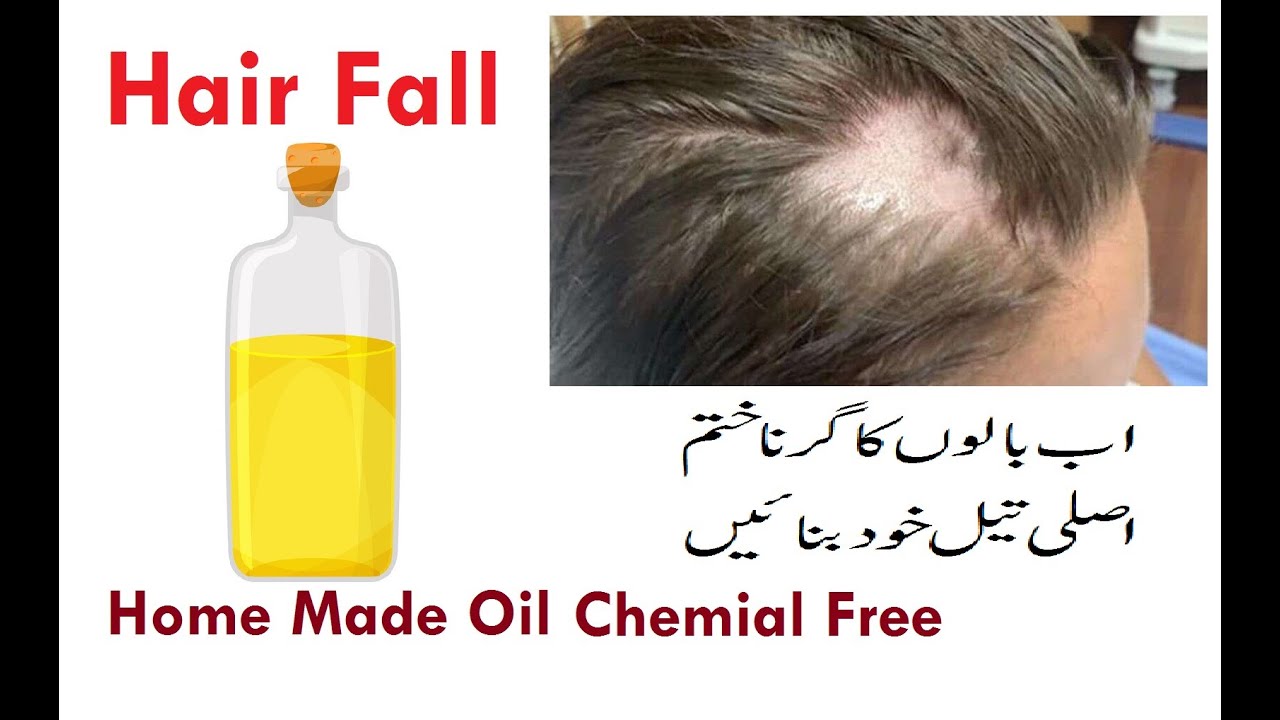Hair fall solution Homemade oil chemical free simple and quick results.