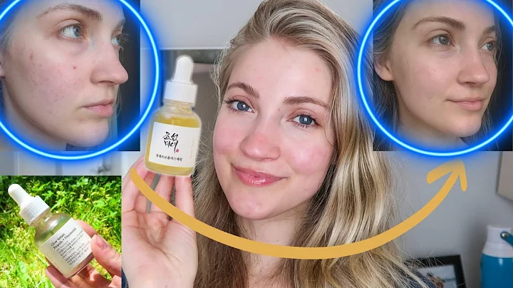 Beauty of Joseon Propolis + Niacinamide Glow Serum Review | DOES IT HELP WITH ACNE SCARS & MARKS?