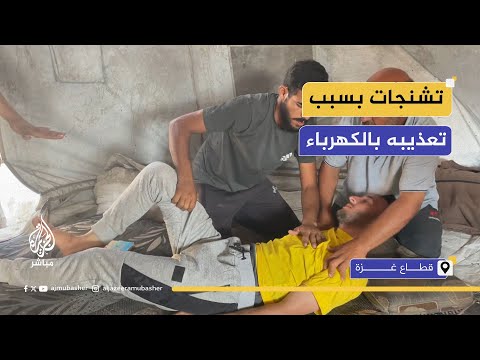 بسبب التع ذيب أسير فلسطيني محرر يصاب بنوبات عصبية وغيبوبة مؤقتة