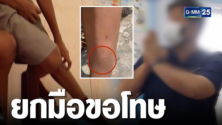 ไหว้ขอโทษ แค่หวังดี! หมอเตะนักเรียน | เกาะข่าวเที่ยง | GMM25
