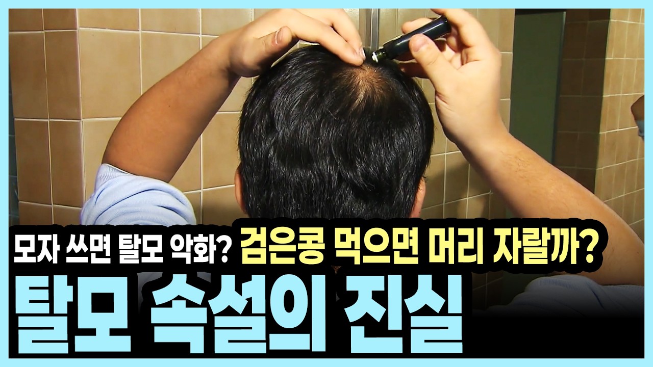 하루 100개 이상 빠지면 탈모? 피부과 전문의가 알기 쉽게 정리한 탈모 원인과 약물 치료법 I KBS 알약톡톡 20160807 방송