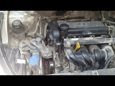 Все о помпе Hyundai Solaris и Kia Rio