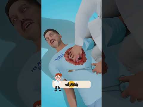 هل يمكن لجسمك النجاة من ثقب ضخم في الصدر