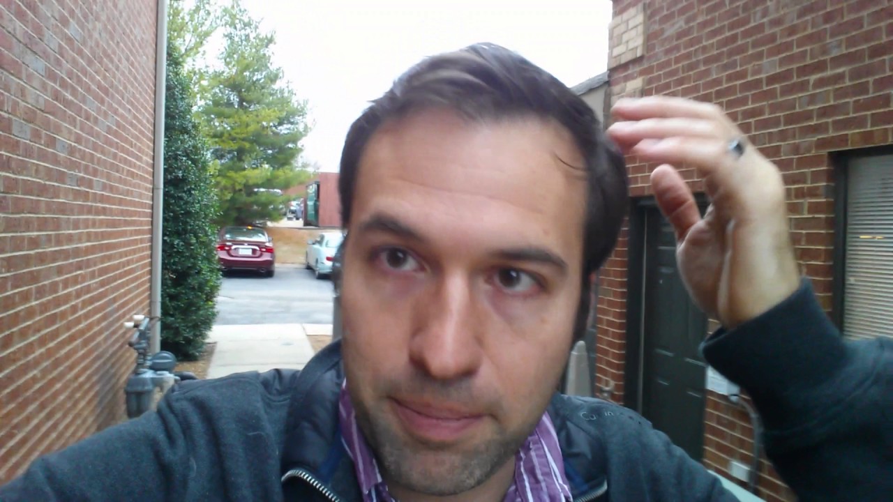 1 Month Later Using Rosemary Oil To Regrow Hair YouTube