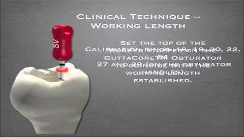 Setting the Working Length when using GuttaCore® with Dr. David Landwehr | Dentsply Sirona