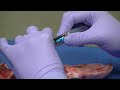 Nv pro3 microlaser laser procedures  continuous vs pulse modes  denmat dental education