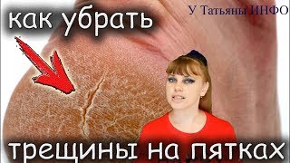 ПЯТКИ КАК У МЛАДЕНЦА! Простой рецепт убрать трещины на пятках.