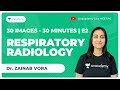 30 Images in 30 minutes | E2 |  | Respiratory radiology | NEET PG | Dr. Zainab Vora