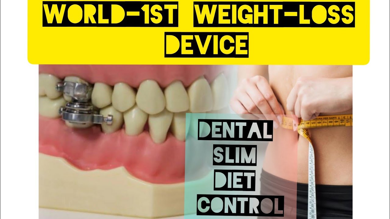 DENTAL SLIM DIET CONTROL DEVICE Worldfirst weight loss dental device