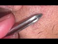 ASMR Beardcare plucking #asmr #beard #plucking 