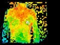 The Clinical Applications of Digital Thermal Imaging