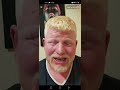 بث ابو حمره مباشر دك فشار اخرب ضحك حالتي