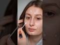 Паста от прыщей #прыщи