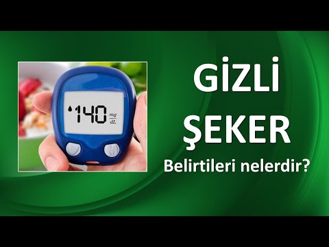 Video: Kötü bir balast direncinin belirtileri nelerdir?