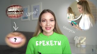 БРЕКЕТЫ, ПОКА 👋🏻 ДО/ПОСЛЕ,  МИНУСЫ, ЧТО ПОШЛО НЕ ТАК? 🤓 ЗАБАВНЫЕ ИСТОРИИ 😂