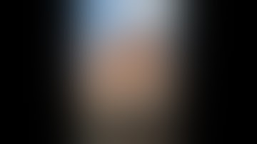 Uniportal Right Middle Lobectomy