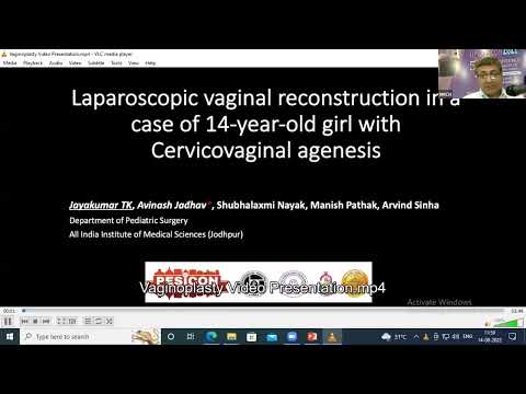 Laparoscopic vaginal reconstruction in a case of 14 y old girl with cervicovaginal agenesis, Jayakum