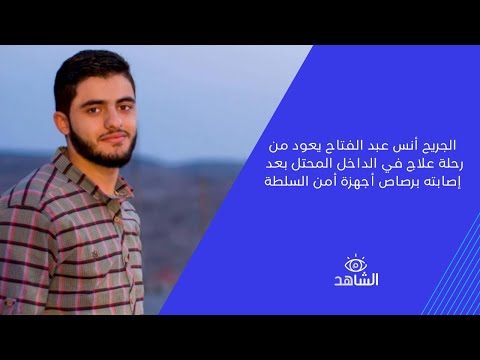 الجريح أنس عبد الفتاح يعود من رحلة علاج في الداخل المحتل بعد إصابته برصاص أجهزة أمن السلطة