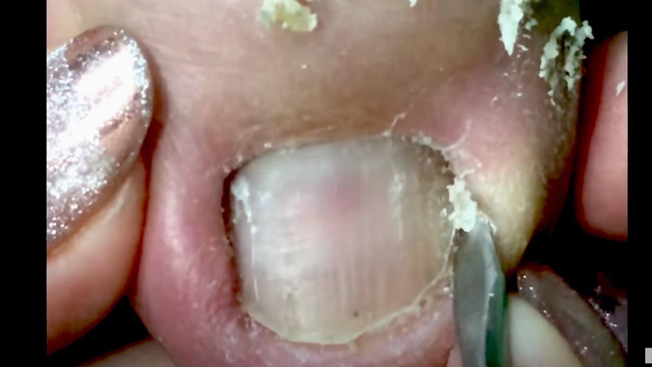 How to Repair Nails easy 392 YouTube